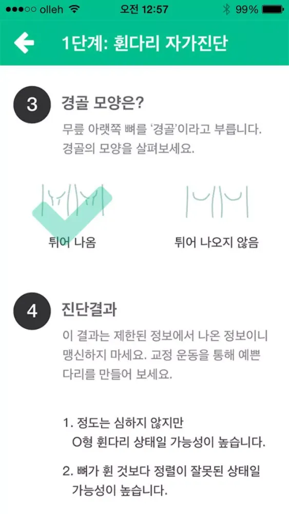 ภาพหน้าจอของ Self 휜다리 클리닉 - O다리? X다리를 교정하고 예방하자! -체형교정/필라테스/스트레칭/비만/다이어트