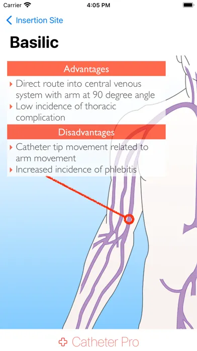 ภาพหน้าจอของ Catheter Pro
