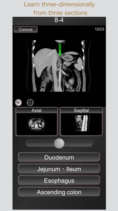 Captures d'écran de CT PassQuiz Abdomen / MRI