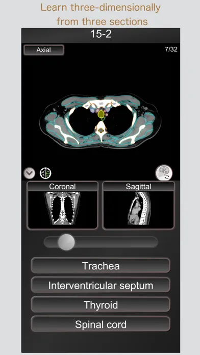 Скриншоты CT PassQuiz Chest / MRI