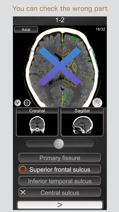 CT PassQuiz Head/Brain / MRI Screenshots