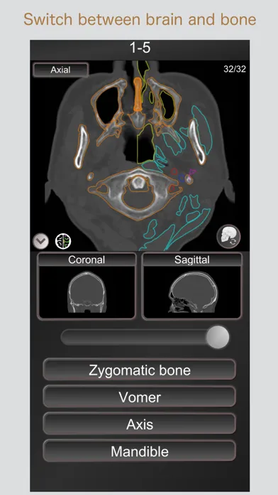 CT PassQuiz Head/Brain / MRI Screenshots
