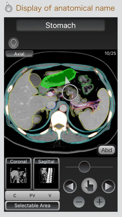 صور CT Passport Abdomen