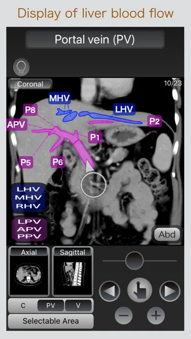 صور CT Passport Abdomen
