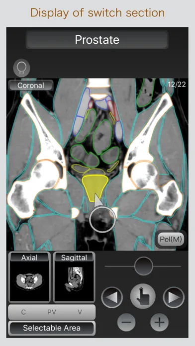 صور CT Passport Abdomen
