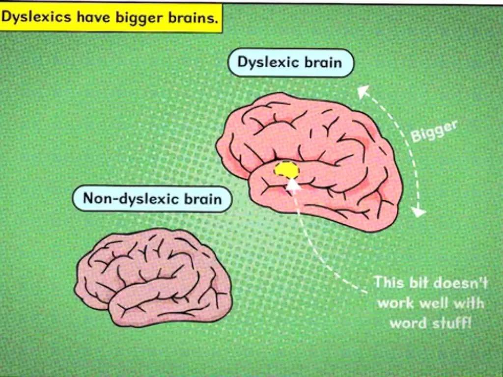 What is Dyslexia? iPad 應用截圖