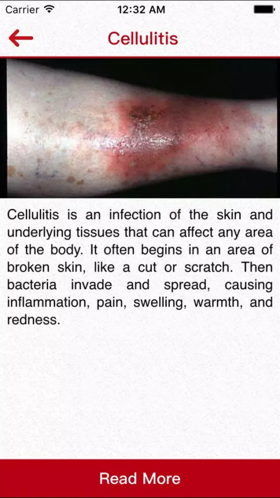 Captures d'écran de Infections
