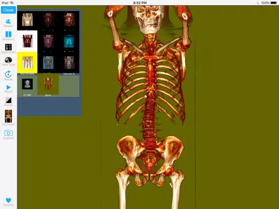ภาพหน้าจอของ Dicom3D - Easy and Powerful iPad 