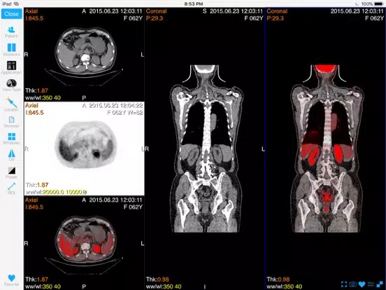 ภาพหน้าจอของ Dicom3D - Easy and Powerful iPad 
