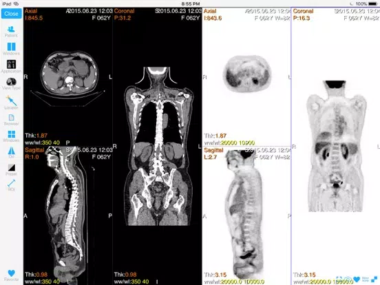 ภาพหน้าจอของ Dicom3D - Easy and Powerful iPad 