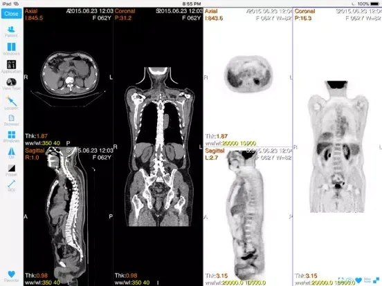 Dicom3D - Easy and Powerful iPad  스크린샷