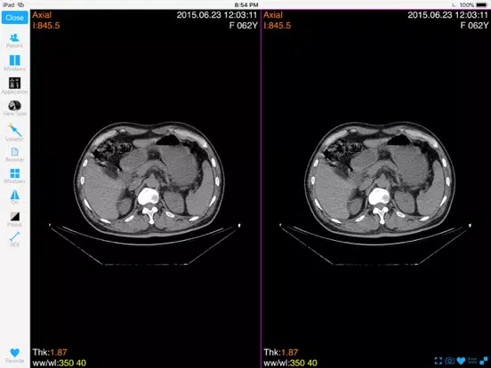 ภาพหน้าจอของ Dicom3D - Easy and Powerful iPad 