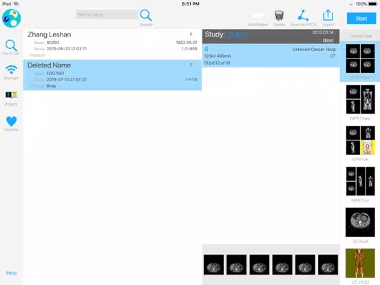 ภาพหน้าจอของ Dicom3D - Easy and Powerful iPad 
