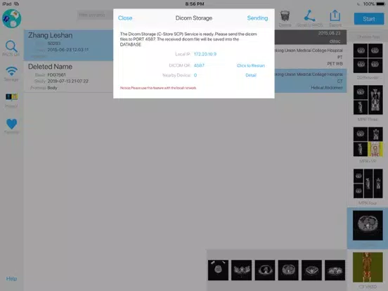 ภาพหน้าจอของ Dicom3D - Easy and Powerful iPad 
