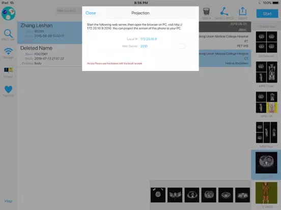 ภาพหน้าจอของ Dicom3D - Easy and Powerful iPad 