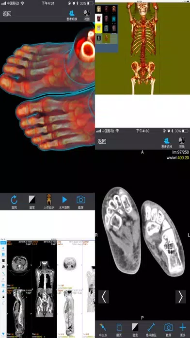 ภาพหน้าจอของ Dicom3D - Easy and Powerful