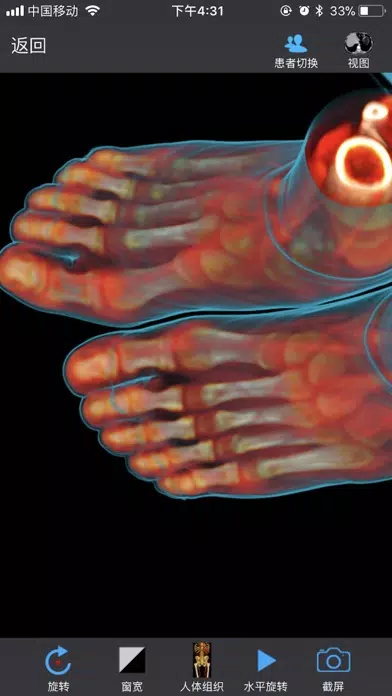 ภาพหน้าจอของ Dicom3D - Easy and Powerful