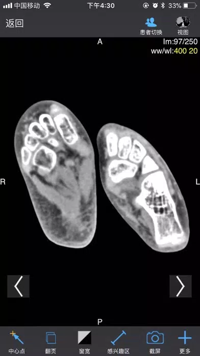 ภาพหน้าจอของ Dicom3D - Easy and Powerful