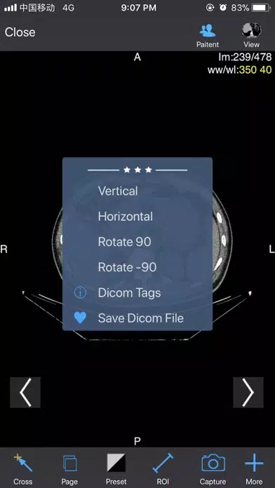 ภาพหน้าจอของ Dicom3D - Easy and Powerful