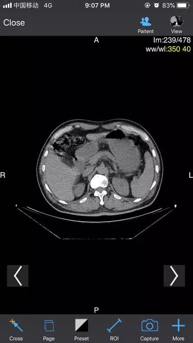 ภาพหน้าจอของ Dicom3D - Easy and Powerful