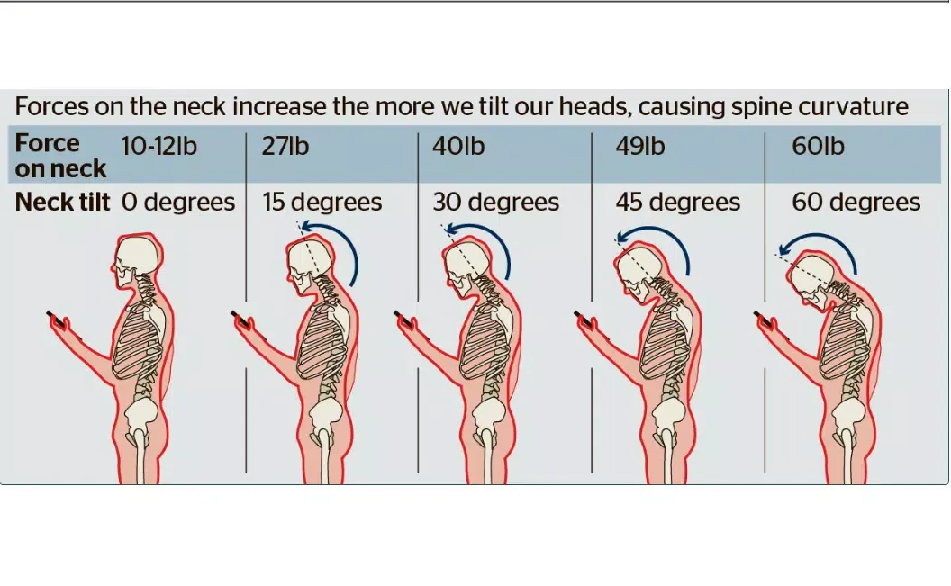 Captures d'écran de Stop Neck Pain