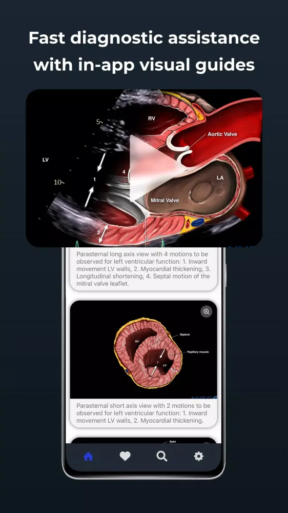 Point of Care Ultrasound Screenshots