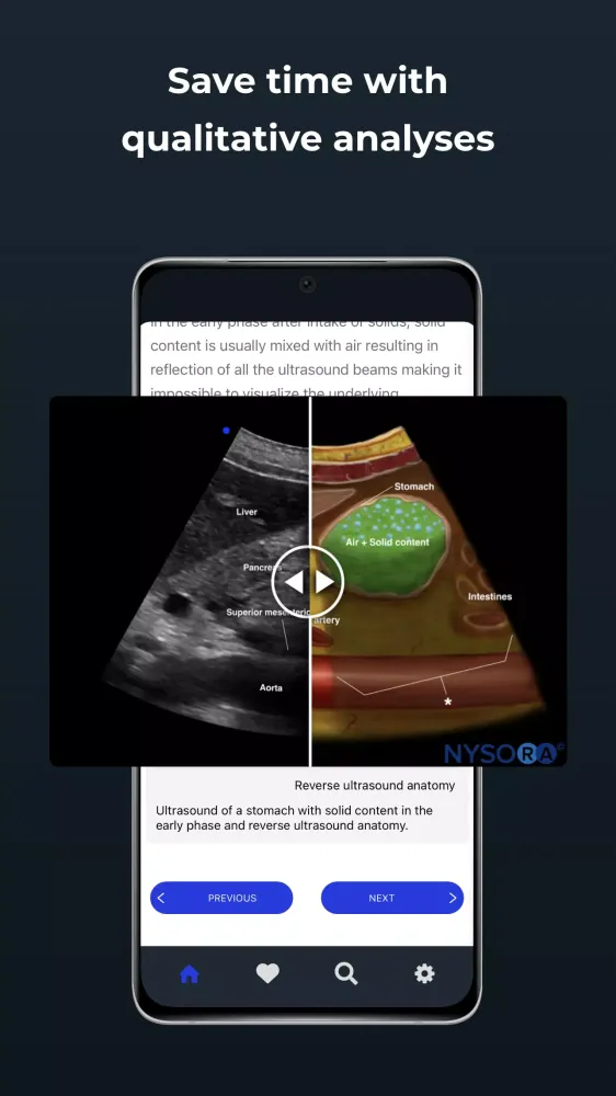 Point of Care Ultrasound Screenshots