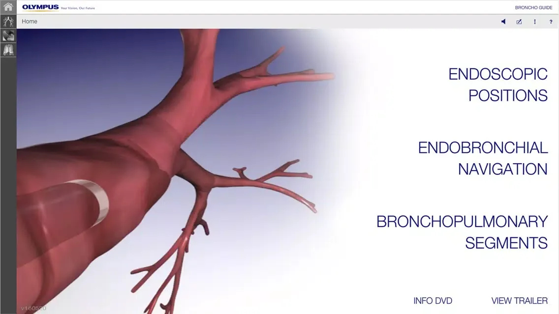 Capturas de tela do BronchoGuide