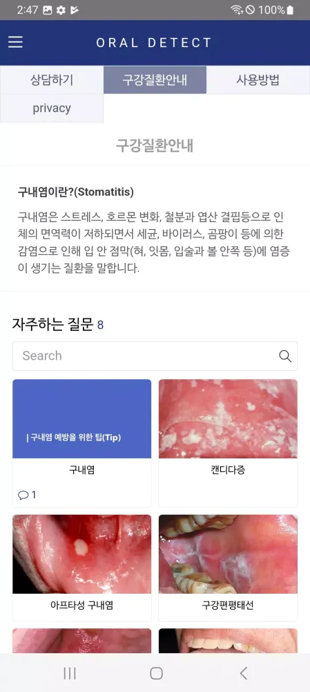 구강암,설암,구강질환관리 스크린샷