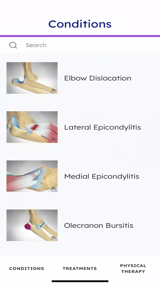 ภาพหน้าจอของ Elbow Decide