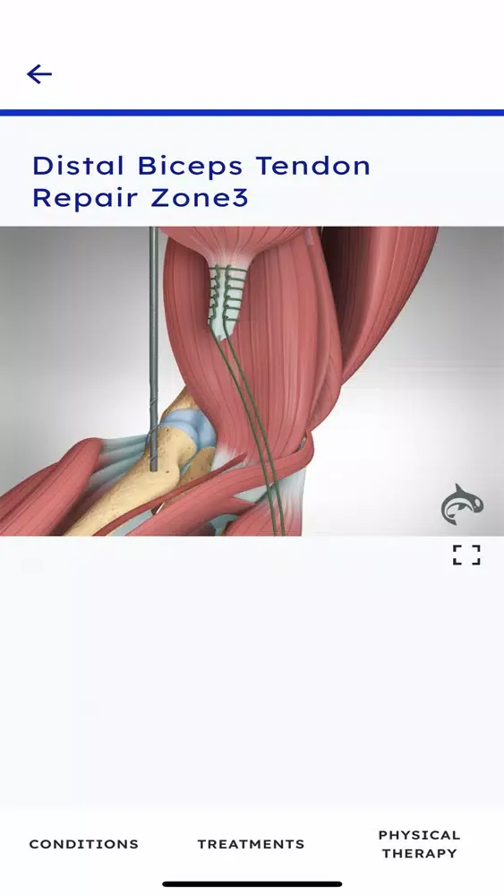 ภาพหน้าจอของ Elbow Decide