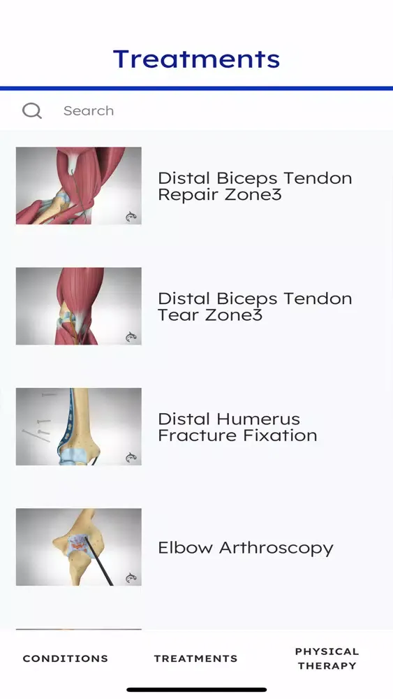 ภาพหน้าจอของ Elbow Decide