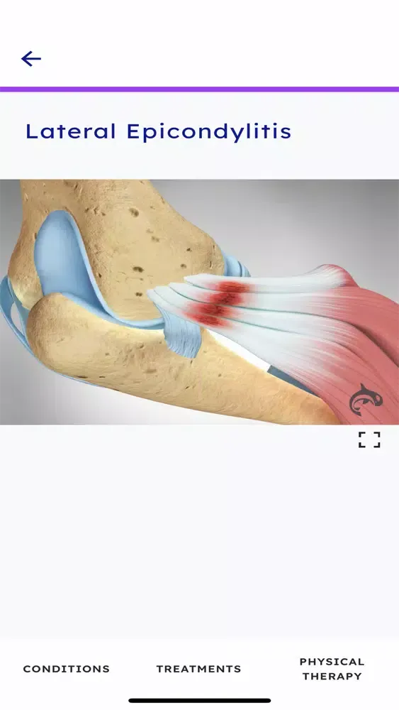 ภาพหน้าจอของ Elbow Decide