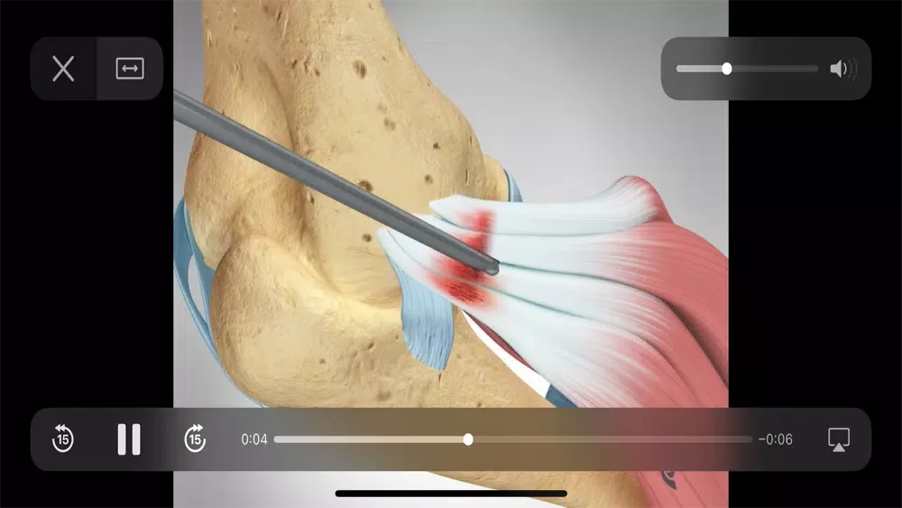 ภาพหน้าจอของ Elbow Decide