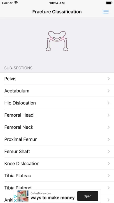 Fracture Classification (FC)应用截图