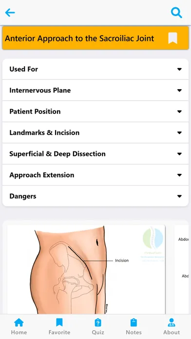 Orthopedic Surgery Approaches स्क्रीनशॉट