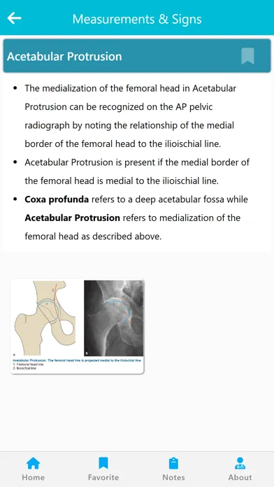 Orthopedic Signs & Angles Ekran Görüntüleri