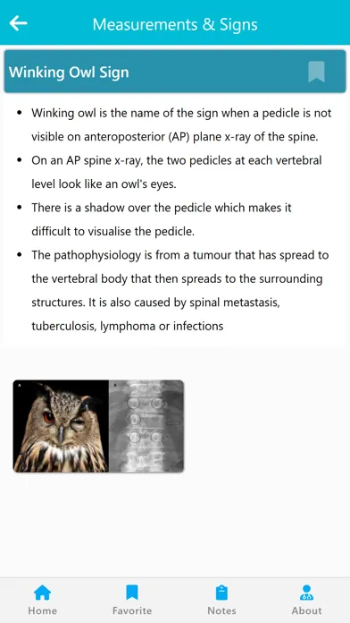 Orthopedic Signs & Angles Ekran Görüntüleri