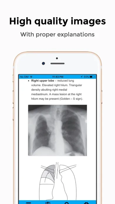 Chest X-Ray FlashCards Screenshots