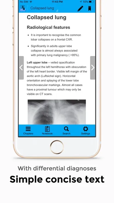 Chest X-Ray FlashCards Screenshots