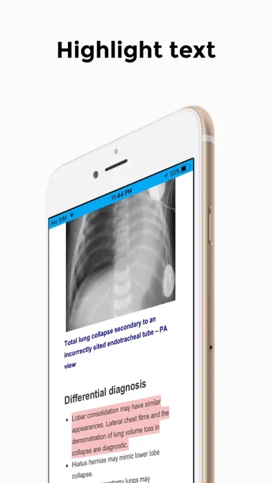 Chest X-Ray FlashCards Screenshots