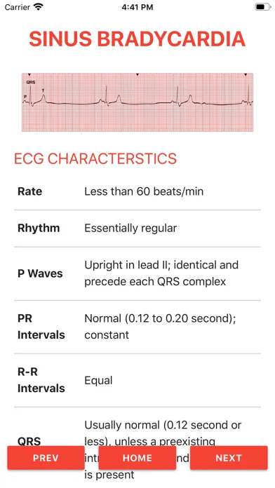 تصاویر ECG FlashCards 2