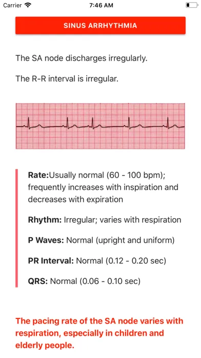 Tangkapan layar ECG FlashCards