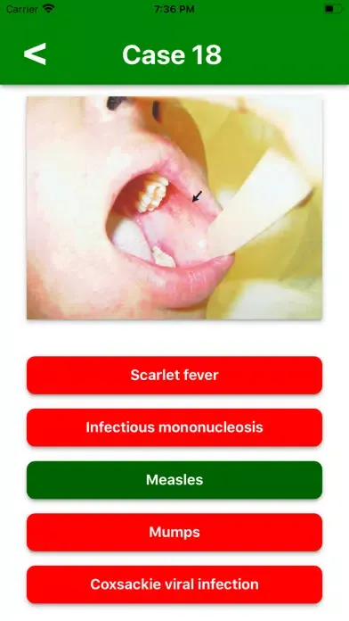 Ảnh chụp màn hình của Spotters 1