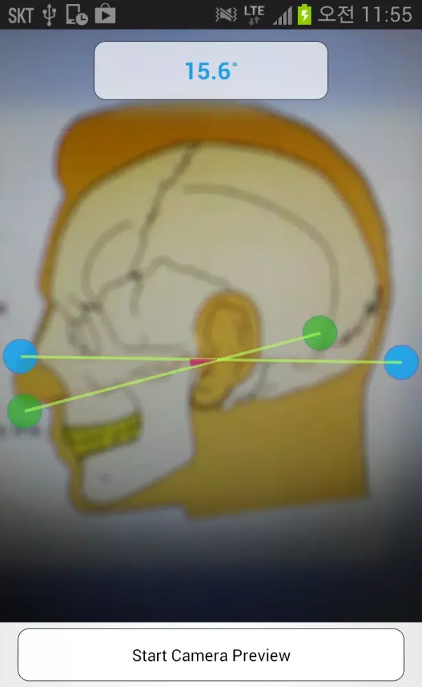 Capturas de tela do Smart Facebow