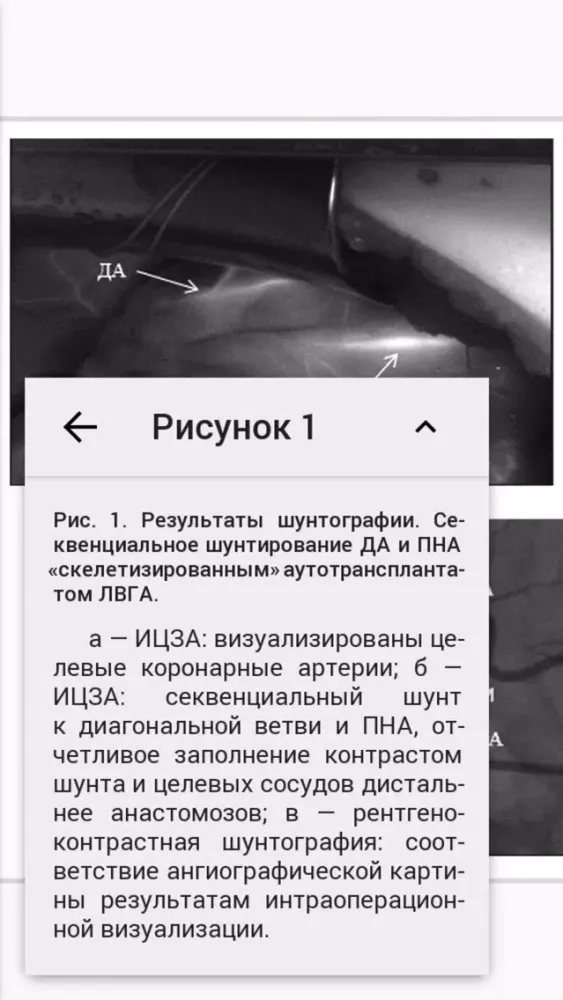Captures d'écran de Кардиология и сердечно-сосудистая хирургия