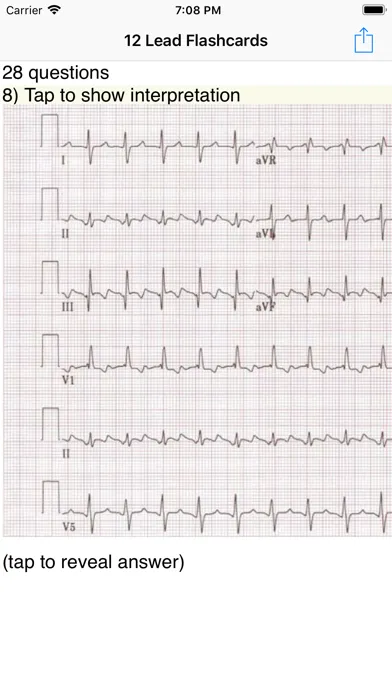 صور EKG Academy