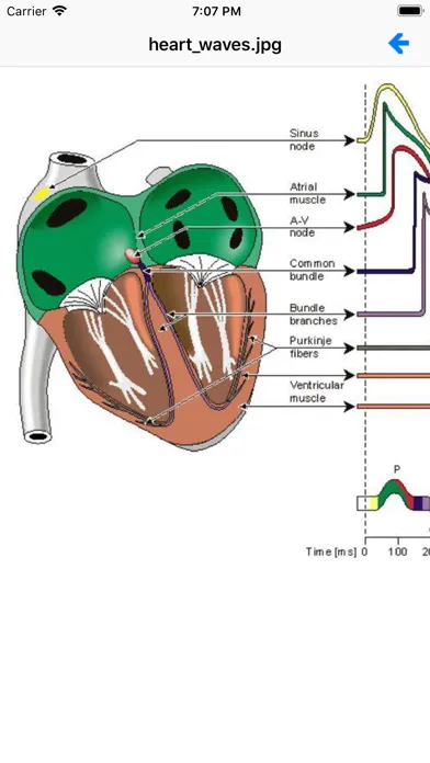 صور EKG Academy