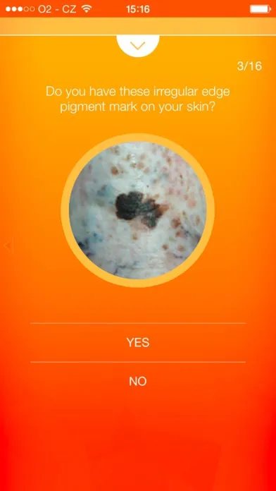 Melanoma Test - risk calculator of skin cancer Screenshots