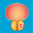 Nyushko prostate nomograms